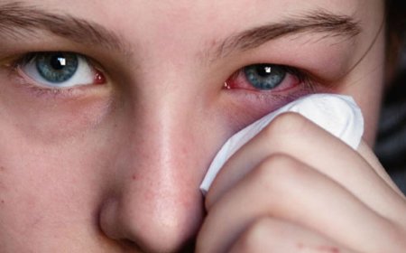 কনজাংটিভাইটিস হলে কী করবেন, টিপস